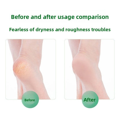 Antibacterial Foot Wash For Stinky Feet With 360° Brush